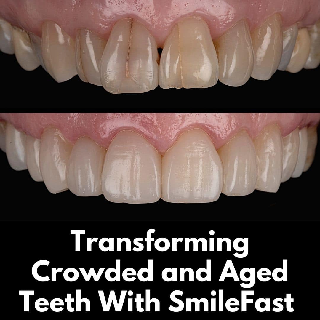 North Bridge Dental Practice SmileFast North Bridge Dental Practice SmileFast