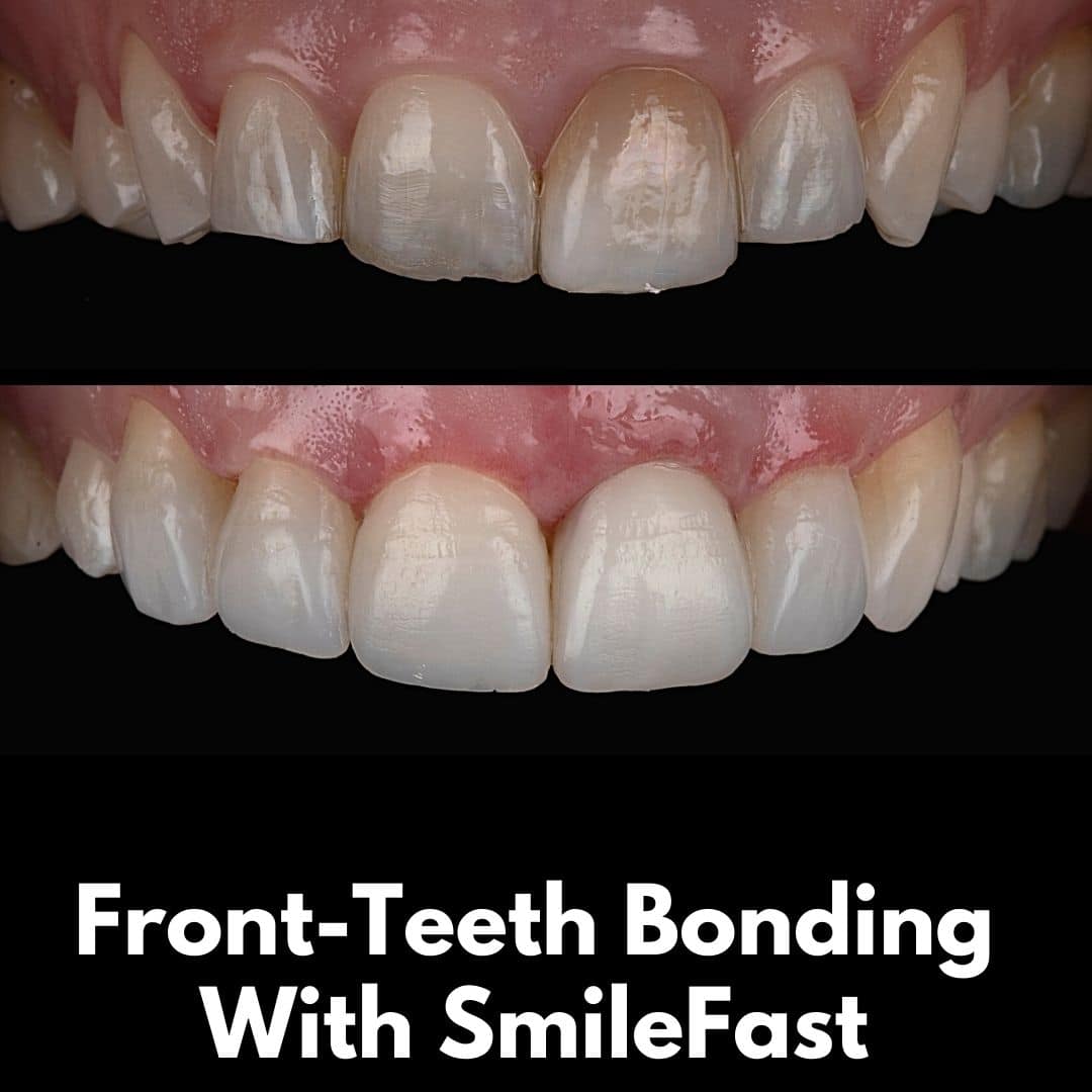North Bridge Dental Practice SmileFast North Bridge Dental Practice SmileFast