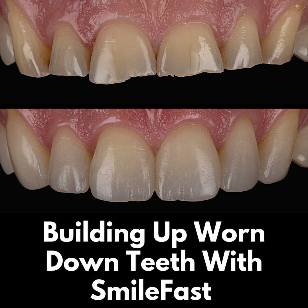 North Bridge Dental Practice SmileFast North Bridge Dental Practice SmileFast
