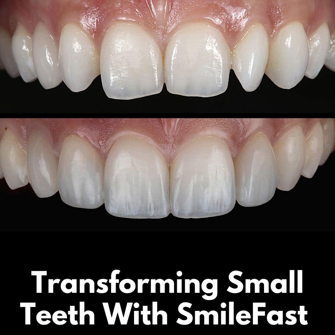 North Bridge Dental Practice SmileFast North Bridge Dental Practice SmileFast