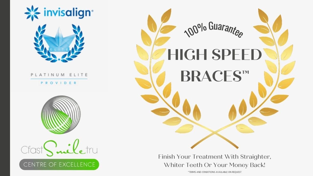 North Bridge Dental Practice Straight Teeth at North Bridge Hawick North Bridge Dental For Your Straight Teeth Treatment