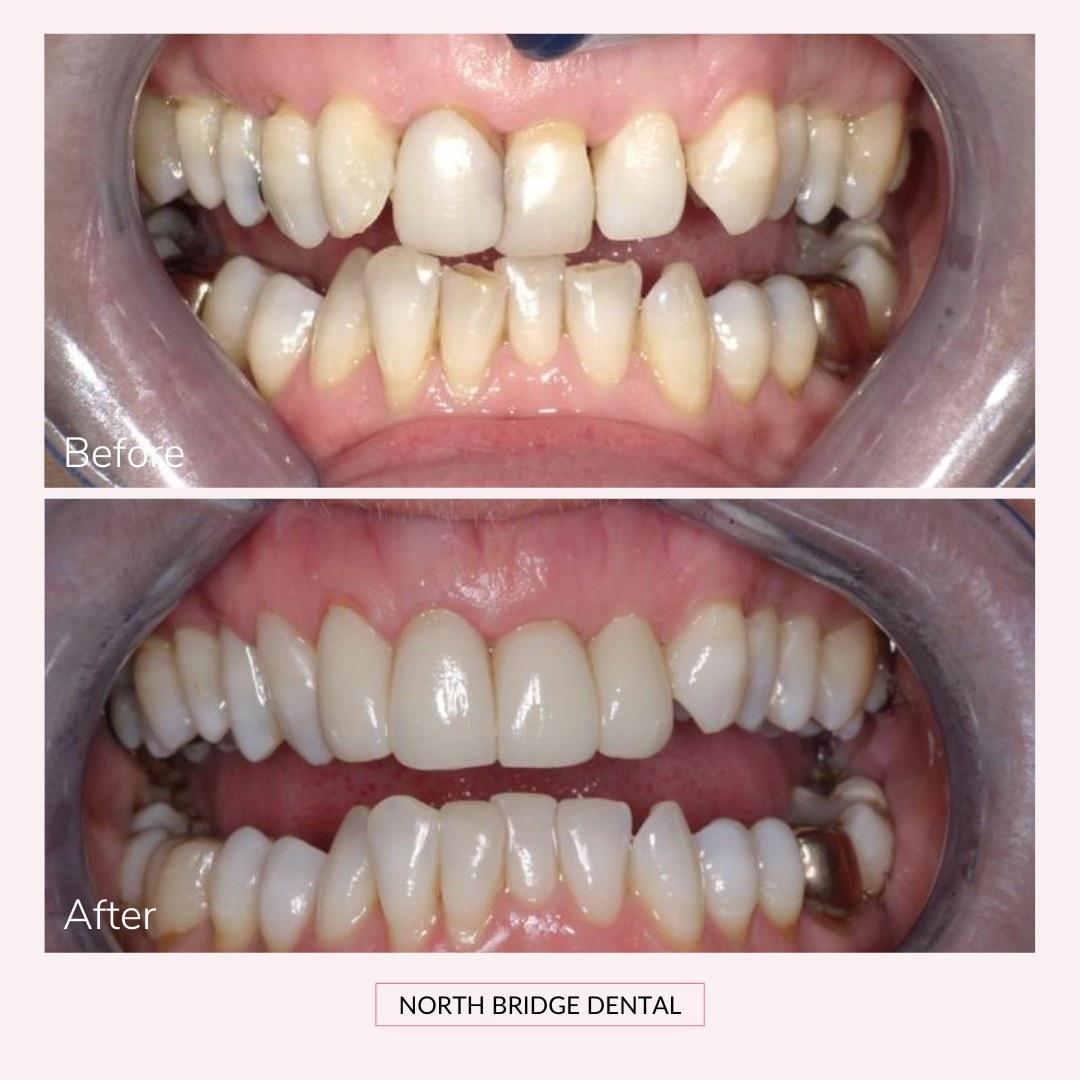 North Bridge Dental Practice Smile Gallery North Bridge Dental Practice Smile Gallery