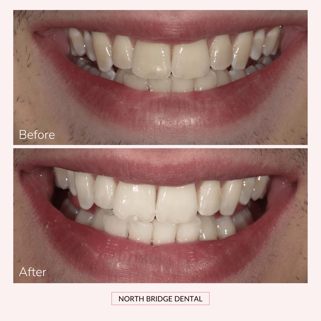 North Bridge Dental Practice Smile Gallery North Bridge Dental Practice Smile Gallery