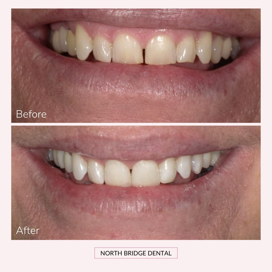 North Bridge Dental Practice Smile Gallery North Bridge Dental Practice Smile Gallery