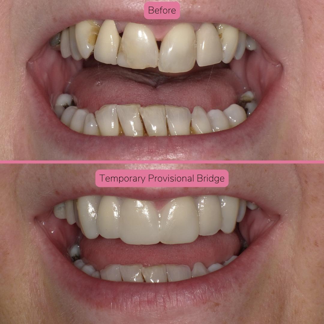 North Bridge Dental Practice Smile Gallery North Bridge Dental Practice Smile Gallery