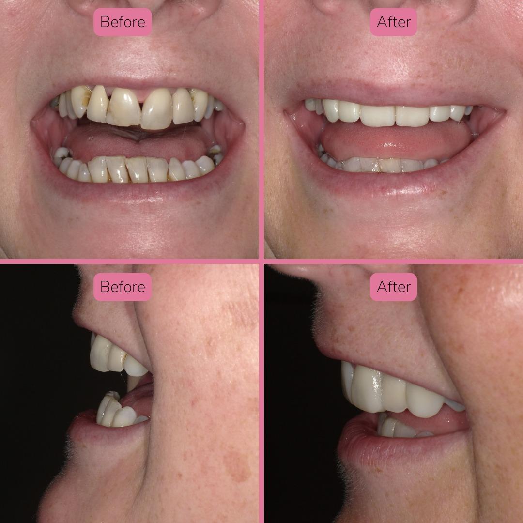 North Bridge Dental Practice Smile Gallery North Bridge Dental Practice Smile Gallery