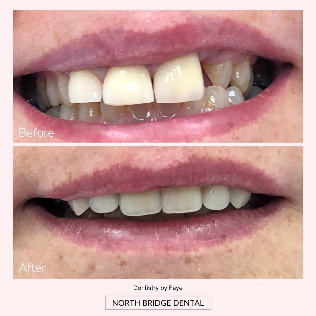 North Bridge Dental Practice Smile Gallery North Bridge Dental Practice Smile Gallery