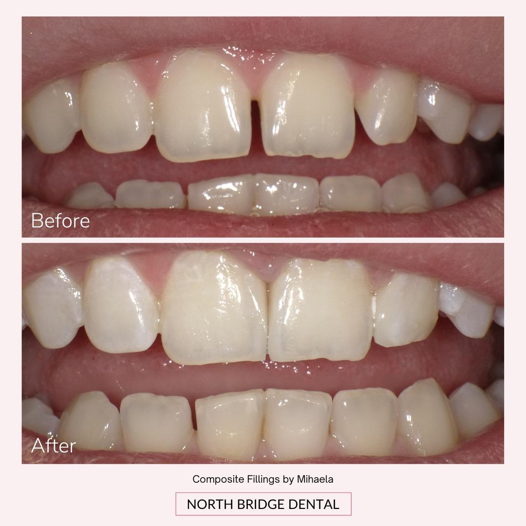 North Bridge Dental Practice Smile Gallery North Bridge Dental Practice Smile Gallery