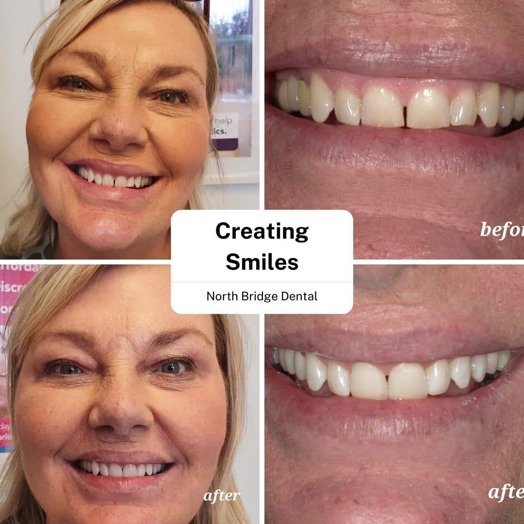 North Bridge Dental Practice Smile Gallery North Bridge Dental Practice Smile Gallery