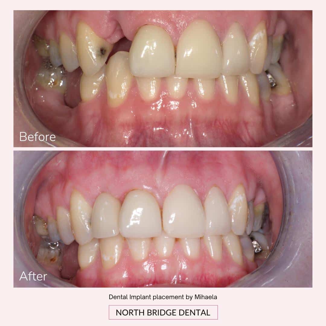 North Bridge Dental Practice Smile Gallery North Bridge Dental Practice Smile Gallery