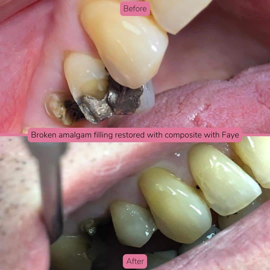 North Bridge Dental Practice Smile Gallery North Bridge Dental Practice Smile Gallery