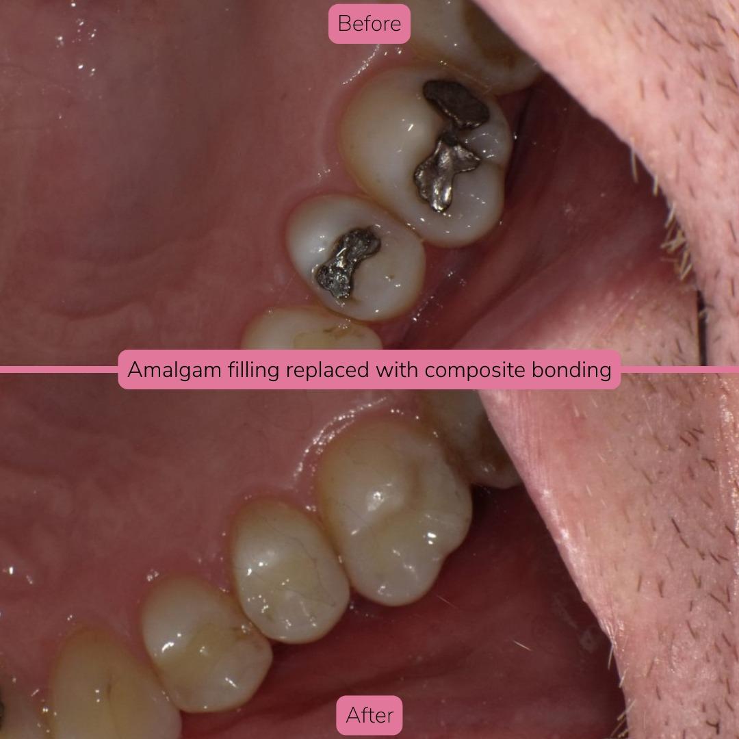 North Bridge Dental Practice Smile Gallery North Bridge Dental Practice Smile Gallery