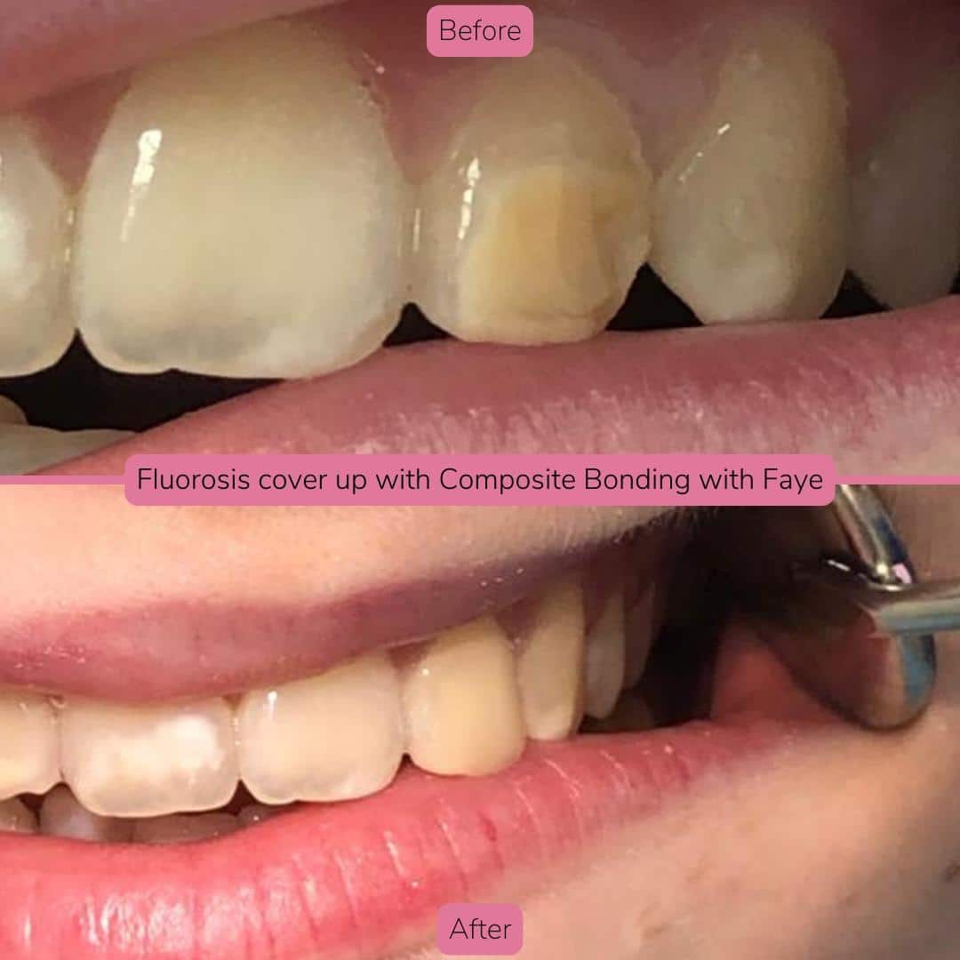 North Bridge Dental Practice Smile Gallery North Bridge Dental Practice Smile Gallery
