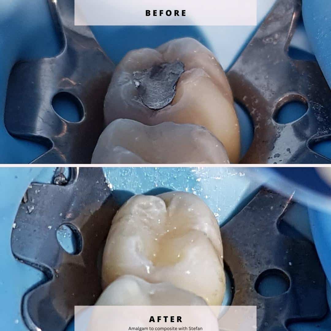 North Bridge Dental Practice Smile Gallery North Bridge Dental Practice Smile Gallery