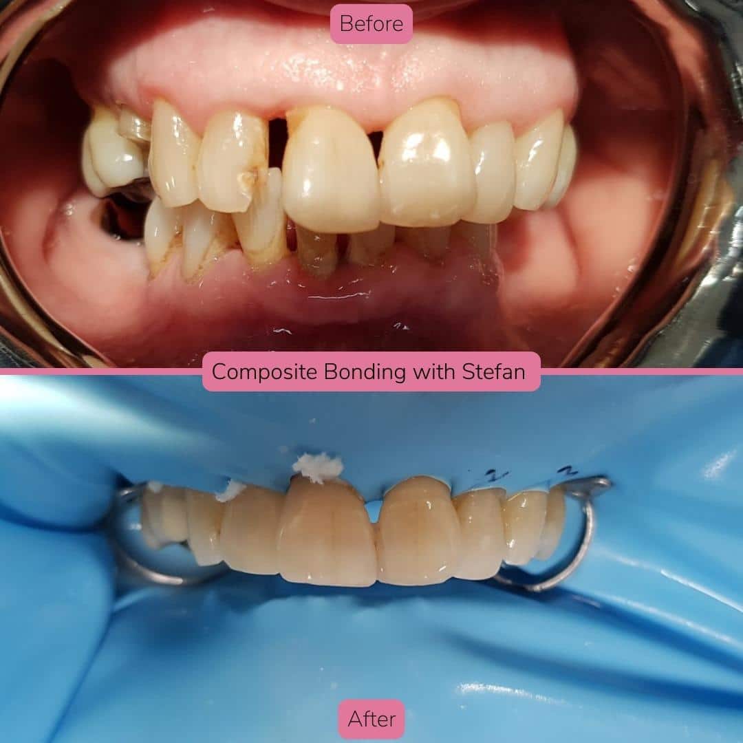 North Bridge Dental Practice Smile Gallery North Bridge Dental Practice Smile Gallery