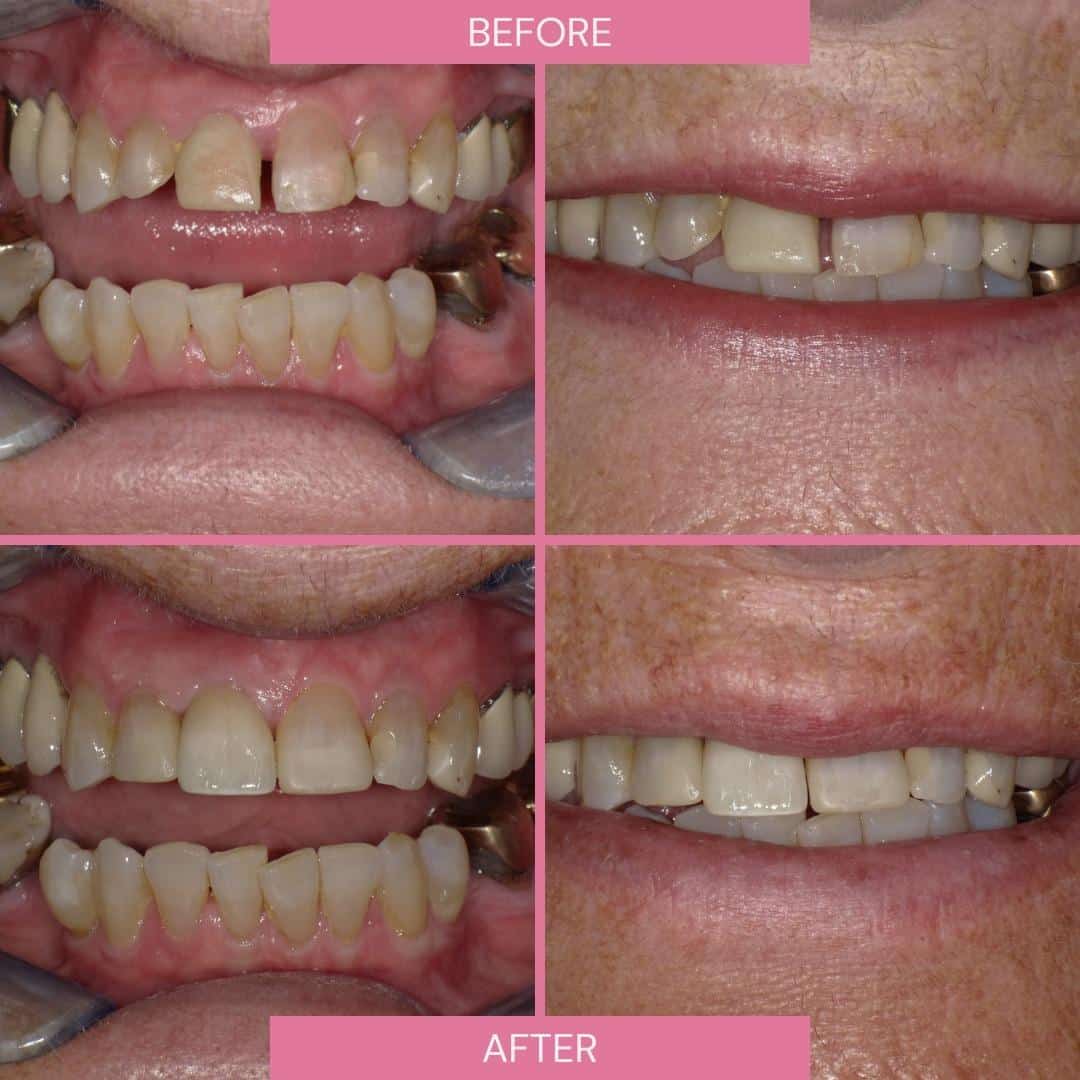 North Bridge Dental Practice Smile Gallery North Bridge Dental Practice Smile Gallery