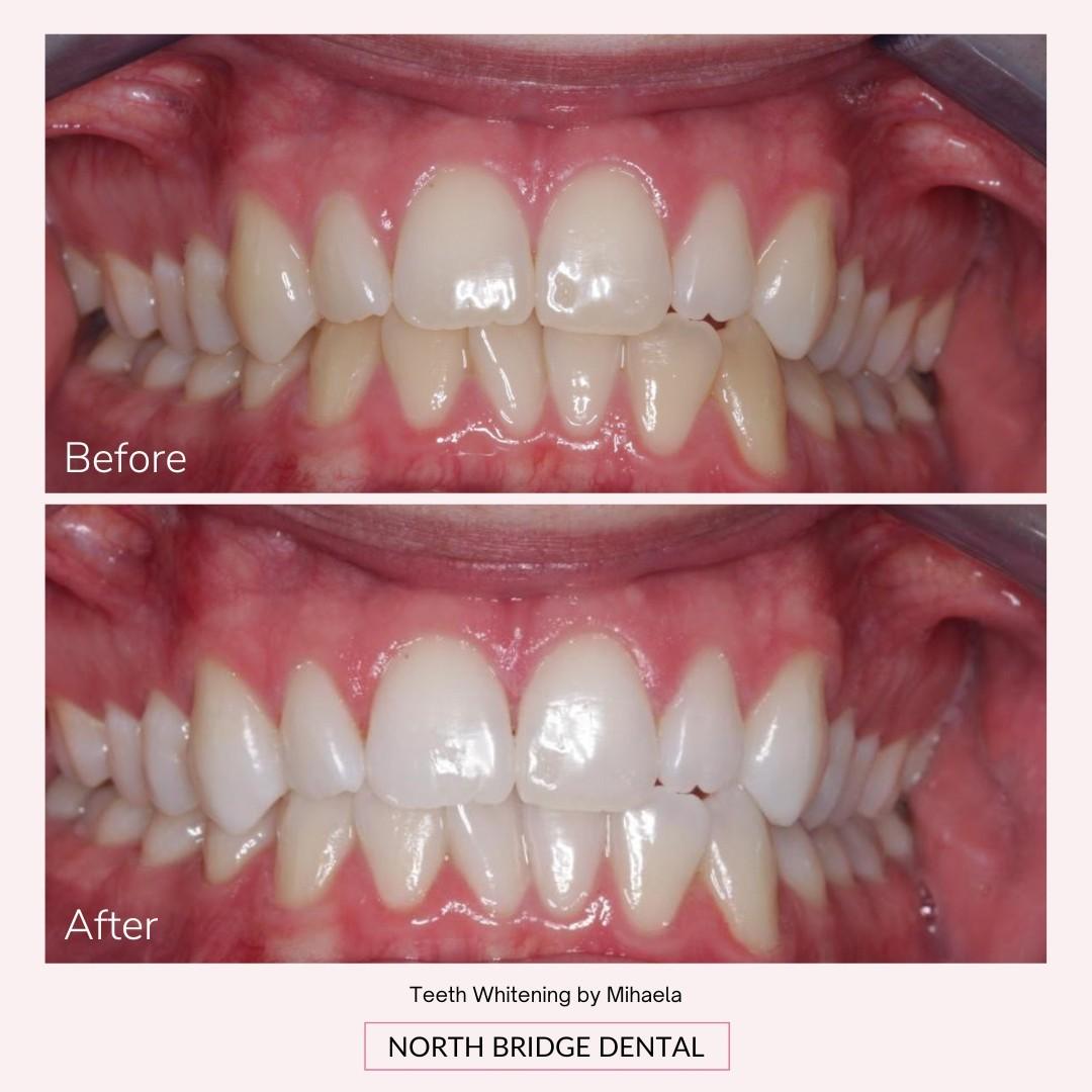 North Bridge Dental Practice Smile Gallery North Bridge Dental Practice Smile Gallery