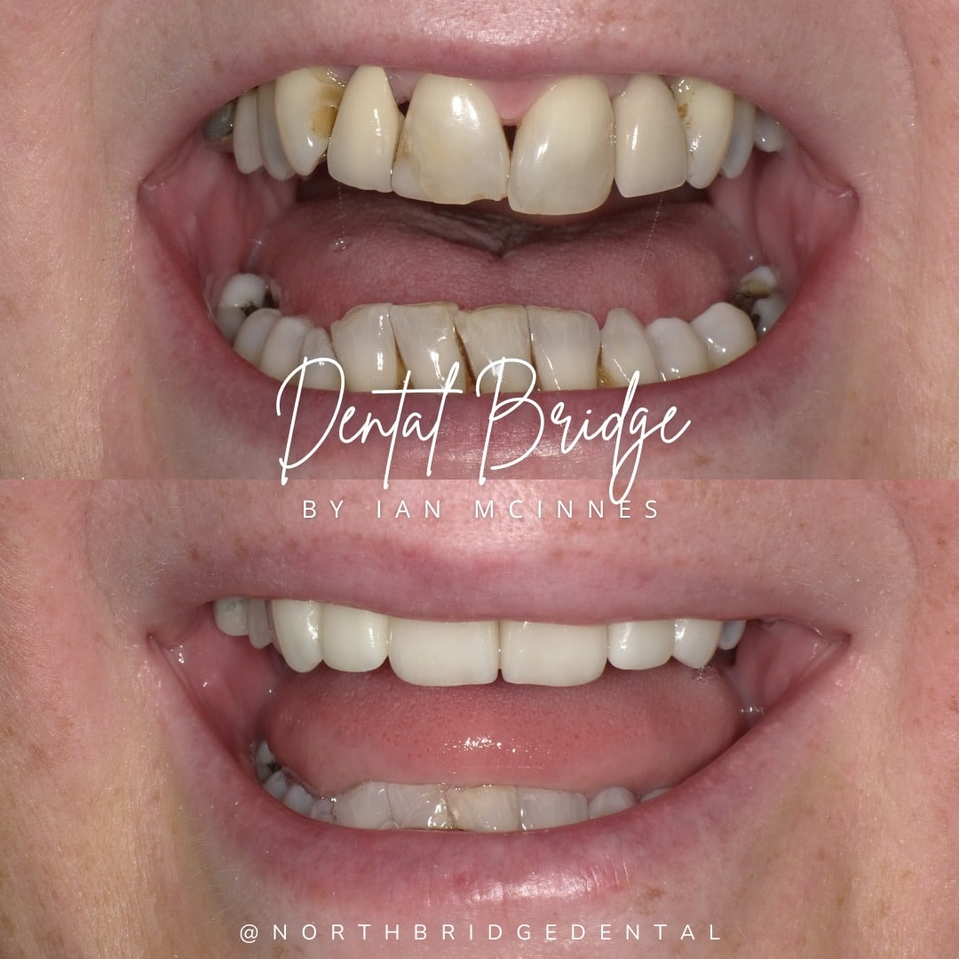 North Bridge Dental Practice Dentist in Burnfoot | North Bridge Dental Hawick North Bridge Dental Practice Dentist in Burnfoot | North Bridge Dental Hawick