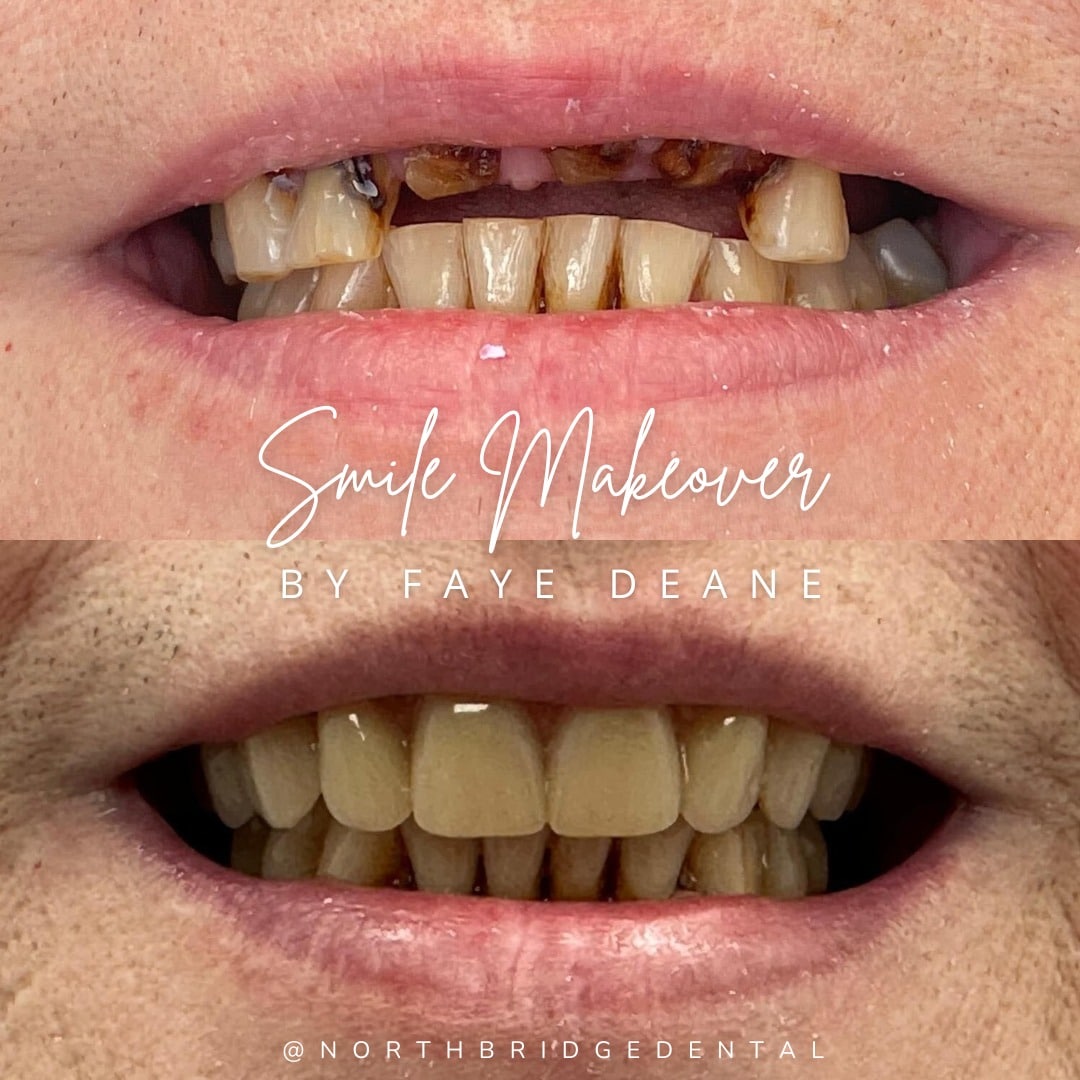 North Bridge Dental Practice Smile Makeovers in Hawick