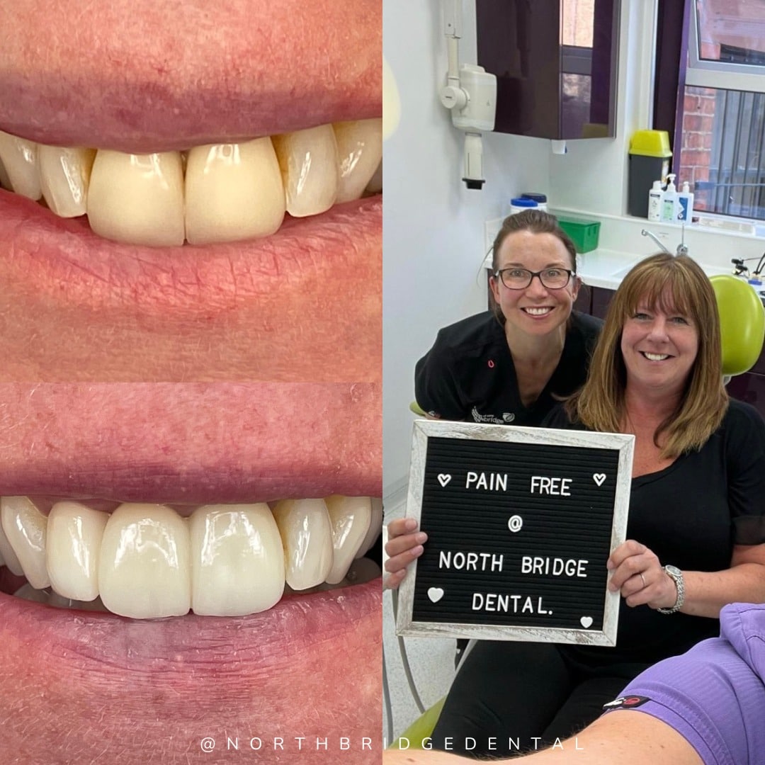 North Bridge Dental Practice Smile Makeovers in Hawick