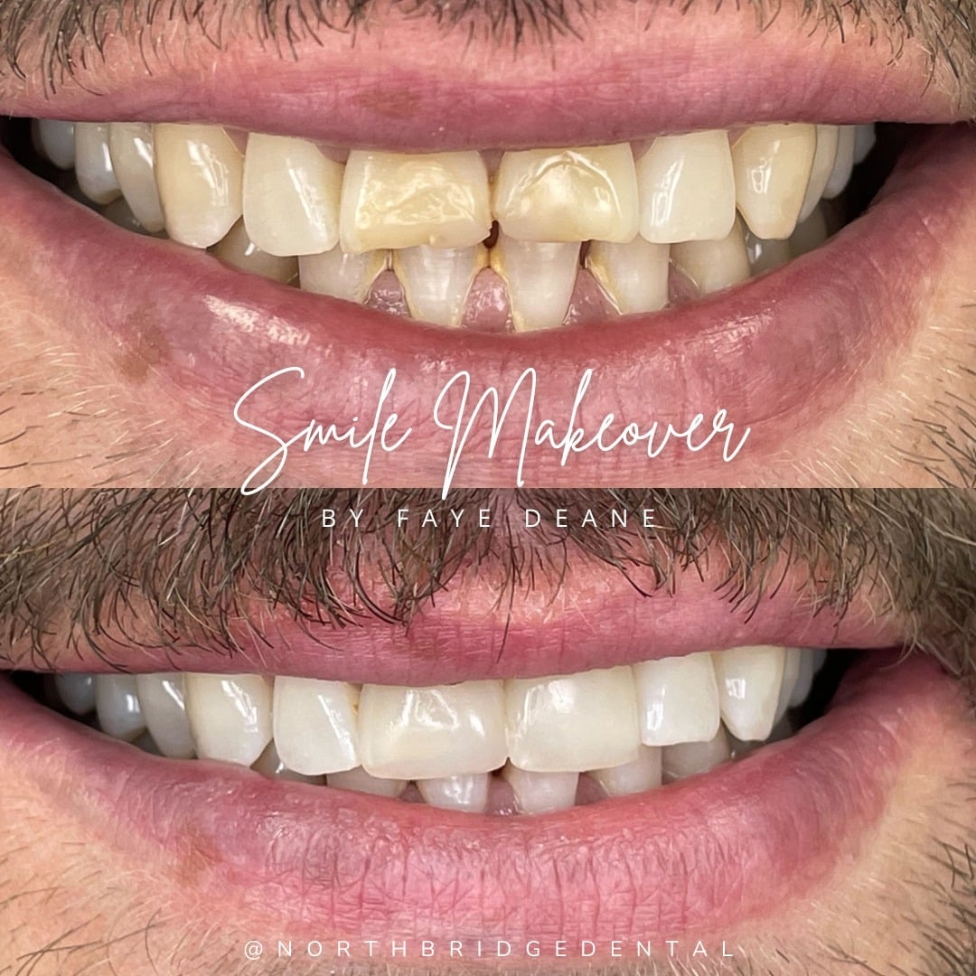 North Bridge Dental Practice Dentist in Burnfoot | North Bridge Dental Hawick North Bridge Dental Practice Dentist in Burnfoot | North Bridge Dental Hawick